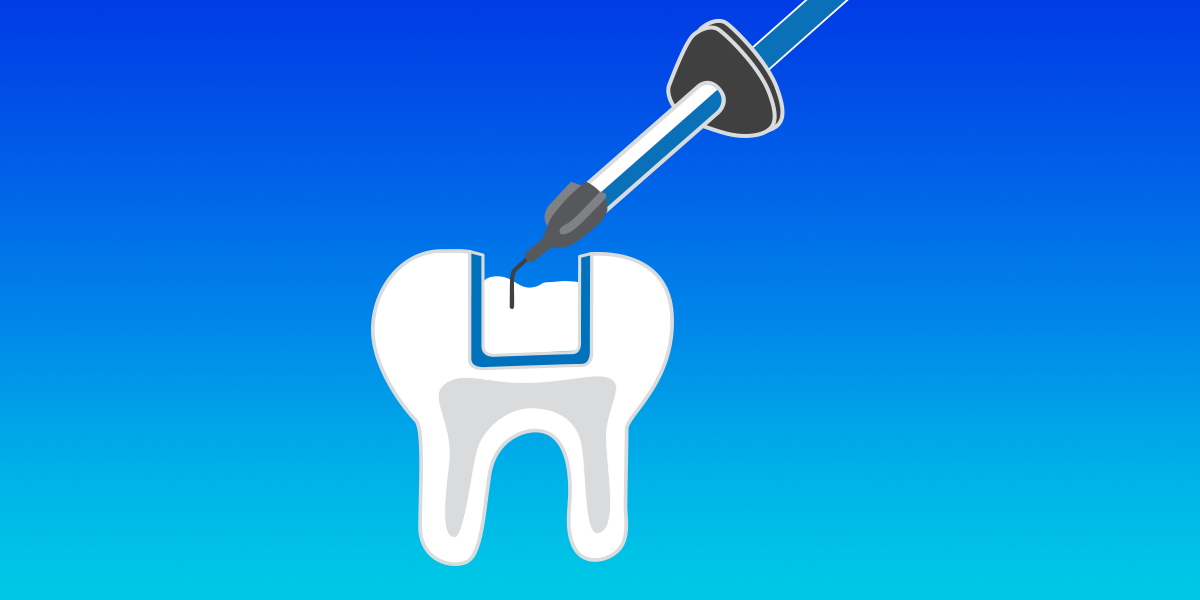 filtek-flowable-illustration-step5-Fill-Tooth-Plandent-Episerver.png