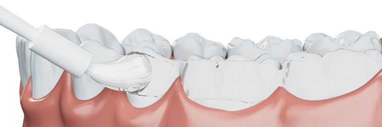 Clinpro Application Picture.png