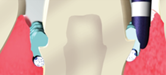 ARTIKE~4.png