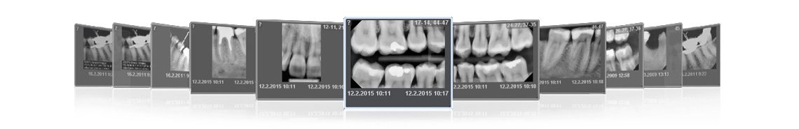 Bilder tagna med Planmeca ProX intraoral röntgen
