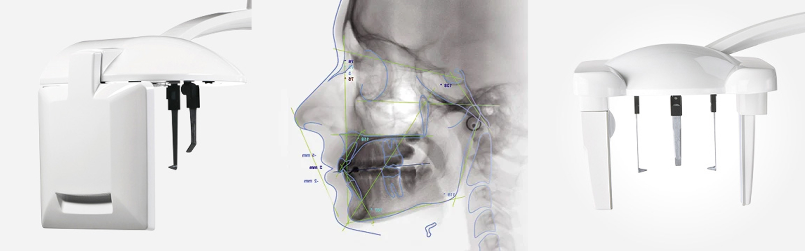 Bild p&aring; Planmecas tv&aring; olika modeller av kefalostat
