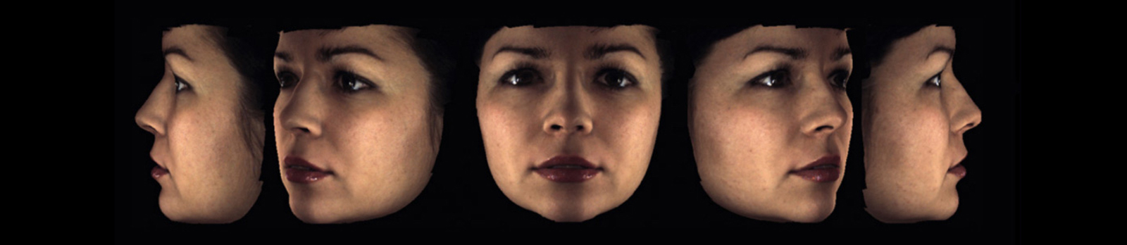 Exempel p&aring; ansiktsfoto med Planmeca ProFace