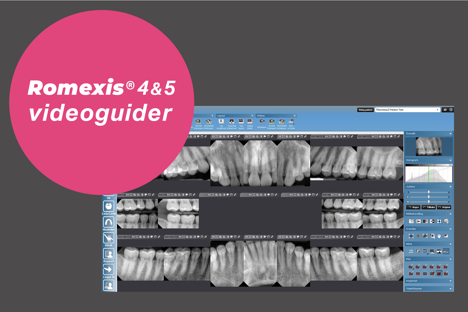 romexis-4-5-videogudier-banner-3x2.png