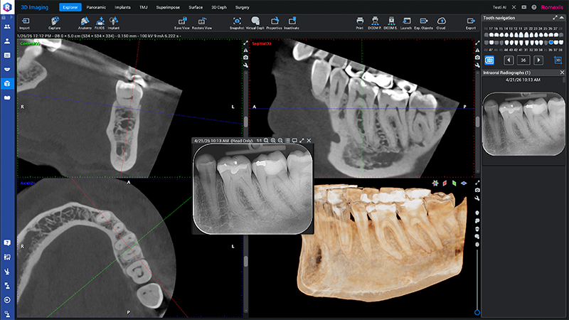 800x450px-Epi_Romexis-3D-okt2026-001.png