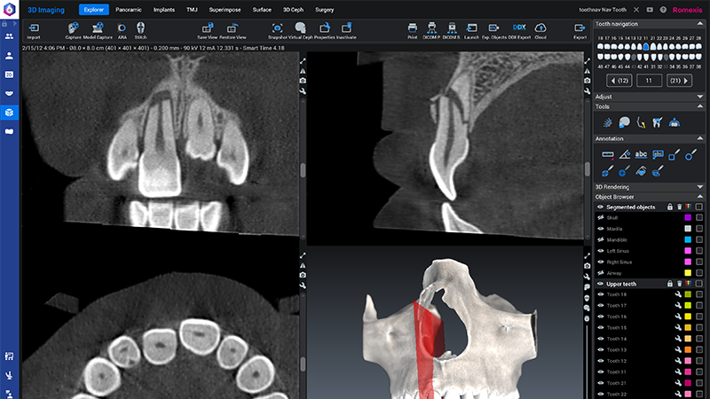 800x450px-Epi_Romexis-3D-okt2026-002.png