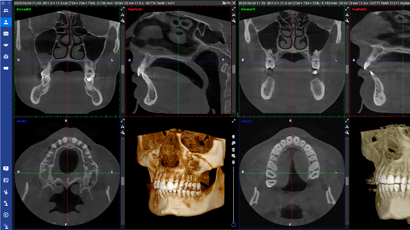 800x450px-THUMBNAIL-Epi_Romexis_3D-okt2026.png